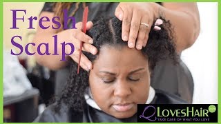 Fresh Scalp Treatment [upl. by Anabahs]