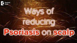 What helps psoriasis on scalp  Dr Rasya Dixit [upl. by Melone123]