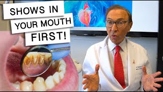 5 Diseases That Show Signs In Your Mouth [upl. by Odessa]