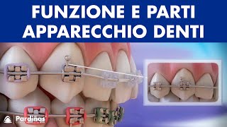 Ortodonzia  Funzione e parti apparecchio denti © [upl. by Angele874]