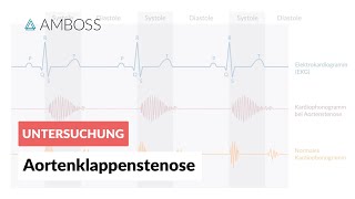 Aortenklappenstenose  Herzgeräusch  AMBOSS Video [upl. by Attecnoc]