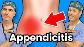 What Causes Appendicitis amp How to Treat It [upl. by Sualocin]