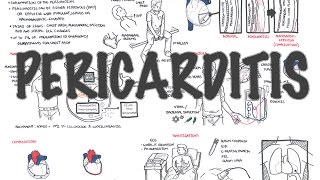 Echocardiography Essentials Detecting pericardial effusions [upl. by Siladnerb]