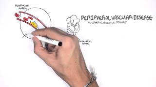 Cardiovascular Disease Overview [upl. by Nitz199]