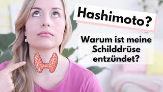 Hashimoto für Anfänger die 5 wichtigsten Basics zur Autoimmunerkrankung [upl. by Dam175]