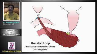 AUG  RUG  Radiographer  Radiology procedure  ascending urethrogram  urology [upl. by Rafaelia]