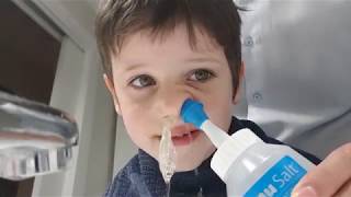 Cómo limpiar la sinusitis a un niño [upl. by Adnana]