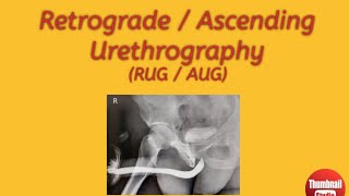 Lecture 4 on male urethrography [upl. by Worl487]