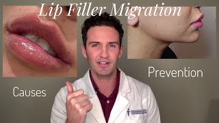 JAWLINE FILLER GONE WRONG  Botched Jawline Contouring [upl. by Orv]