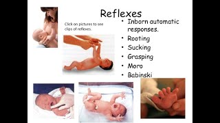 newborn reflexes [upl. by Retxab]