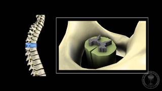 Neuroanatomy  The spinal cord [upl. by Nievelt]