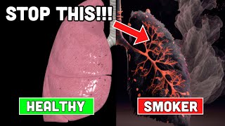 Doctor Explains How to PURIFY Smokers Lungs [upl. by Anitahs257]