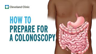 ColonoscopyPreparation for a colonoscopy [upl. by Iggem]