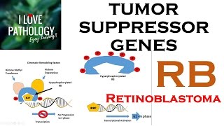 NEOPLASIA 3 TUMOR SUPPRESSOR GENES Retinoblastoma Gene Knudsons Two Hit Hypothesis [upl. by Edgell]