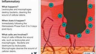 Wound Healing Process [upl. by Lightman]