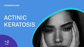 Actinic Keratosis Dermatology [upl. by Kcirb]