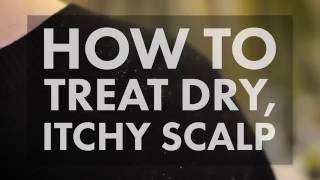 How to Treat a Dry Itchy Scalp  WebMD [upl. by Okoyik]