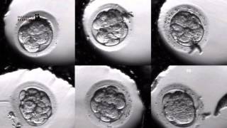 IVF PROCESS STEP BY STEP In Vitro Fertilisation Embryo cultivation [upl. by Elga]