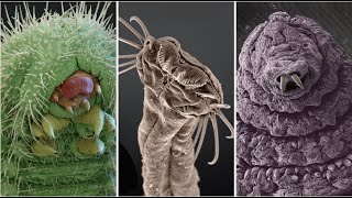 Astonishing Electron Microscope Images [upl. by Diandre]