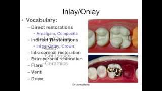 Introduction to inlaysonlays [upl. by Oakley]