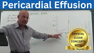 Pericardial Effusion  Pericardium  Cardiology🫀 [upl. by Georgette249]