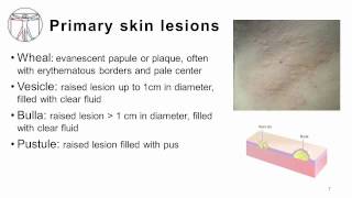 4 Primary and Secondary skin lesions [upl. by Randall]