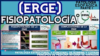 ENFERMEDAD POR REFLUJO GASTROESOFÁGICO FISIOPATOLOGÍA  GuiaMed [upl. by Yetsirhc]